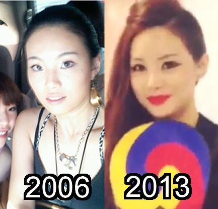 miryp%20ps%20Plastic%20Surgery%20before%