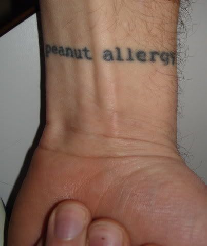 Most tattoo allergy cases are