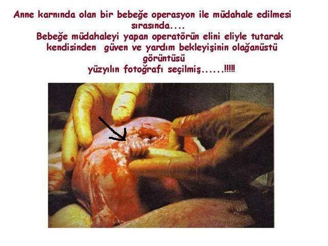 yzylnfotosu7ii5kf2ff0hotv1.jpg