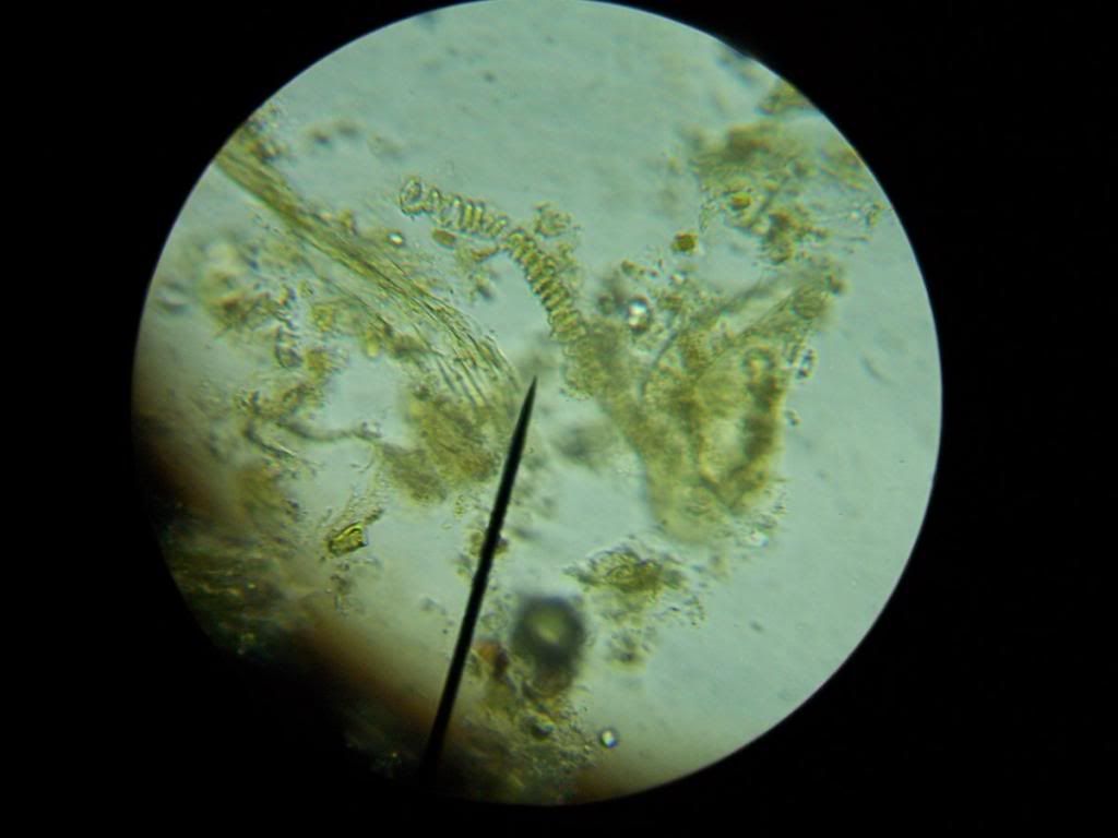 Fecal Tests (pic included) - Goats